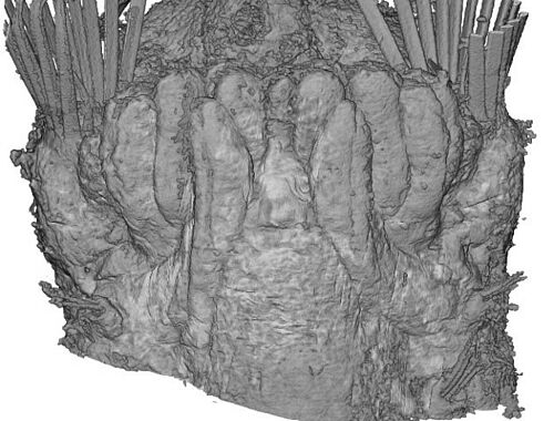 Dreidimensionale Mikro-CT-Aufnahme vom Vorderende von Anobothrus konstantini, erkennbar sind die Bruchstellen der acht Kiemen. 